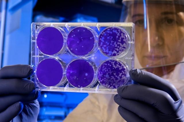Single-Use Bioprocessing in Protein Production: 2025 Trends